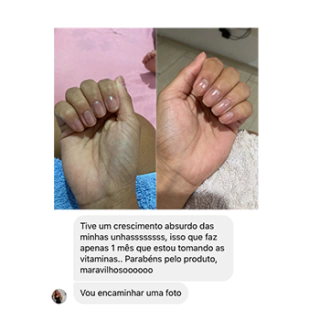 Print de cliente mostrando as unhas antes e depois